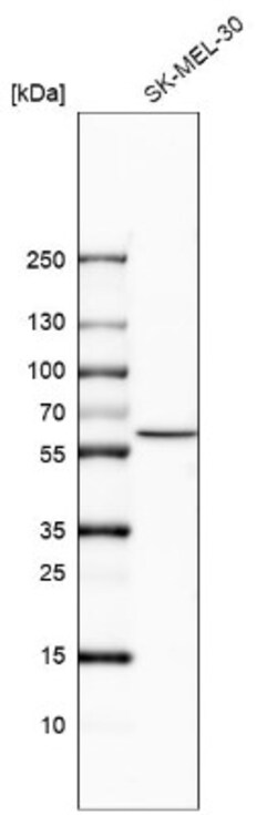 PLA2G4C Antibody, Novus Biologicals 0.1mL; Unlabeled:Antibodies, Polyclonal